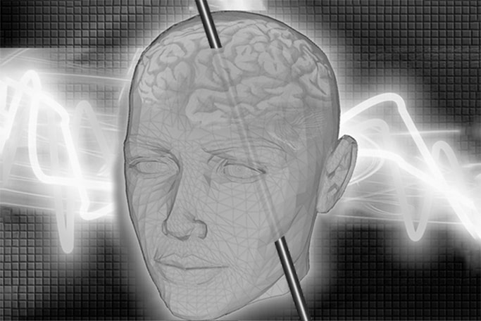 Phineas Gage: History, Facts, & Importance in Psychology